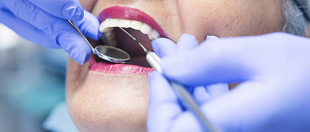 Best Emergency Tooth Extraction in New Baden, IL
